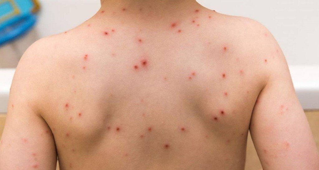 SSA EMITE RECOM 28MAYO2022